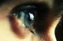 human eye